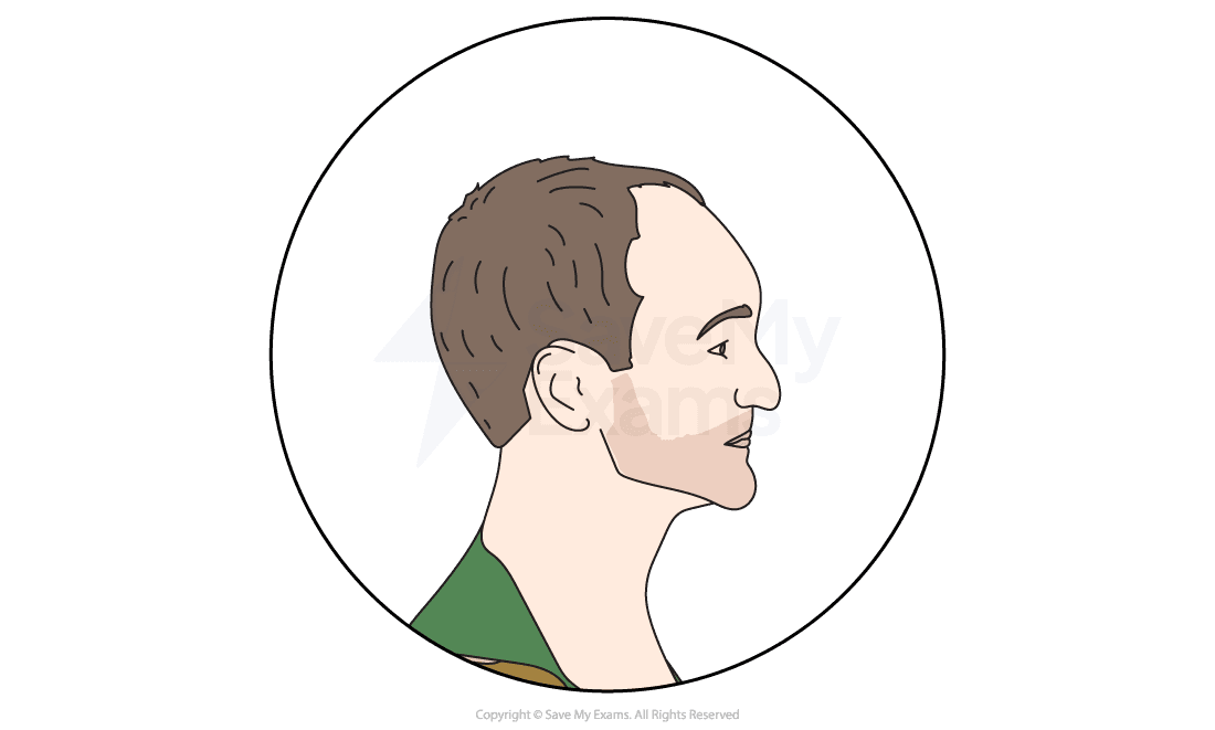 Illustration of a man's side profile within a circle, showing short brown hair and a green shirt on a plain white background.