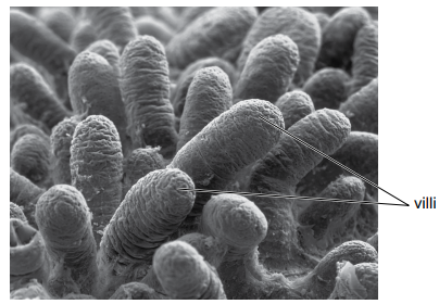 CIE IGCSE 2023 Paper 4 Q1 villi